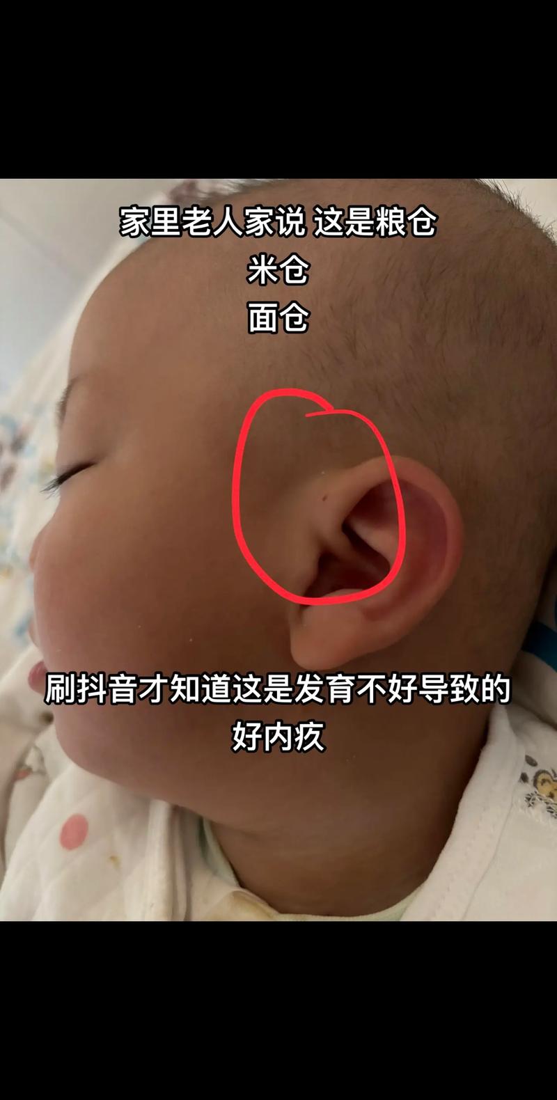 新生儿耳仓会藏污纳垢吗?日常护理要注意哪些细节才能避免感染?-第1张图片-郑州医学网 新生儿耳仓会藏污纳垢吗?日常护理要注意哪些细节才能避免感染?-第1张图片-郑州医学网