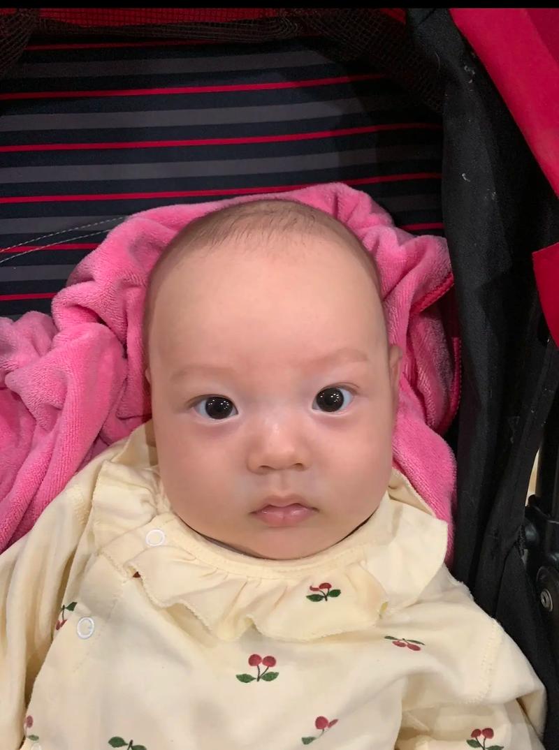 新生儿突然斗鸡眼僵直-第2张图片-郑州医学网