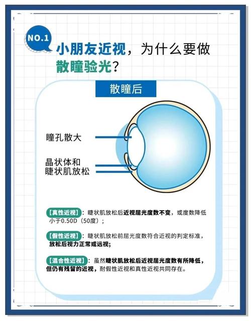 儿童眼睛融合范围正常值是多少？不同年龄段差异大吗？如何判断孩子融合功能是否达标？-第1张图片-郑州医学网