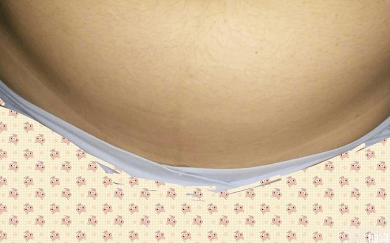 孕期肚子没长妊娠线，是不是胎儿发育异常？-第2张图片-郑州医学网