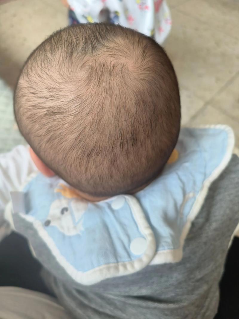 新生儿头顶软那块为什么不跳？是发育异常还是正常现象？-第2张图片-郑州医学网