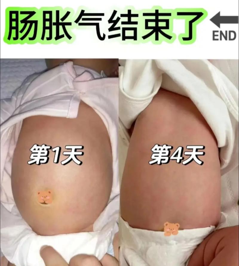 新生儿胀气有哪些典型症状？家长该如何辨别与应对？-第2张图片-郑州医学网