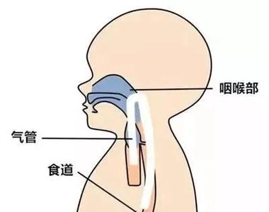新生儿奶呛到气管会有哪些症状？家长如何快速识别与应对？-第3张图片-郑州医学网