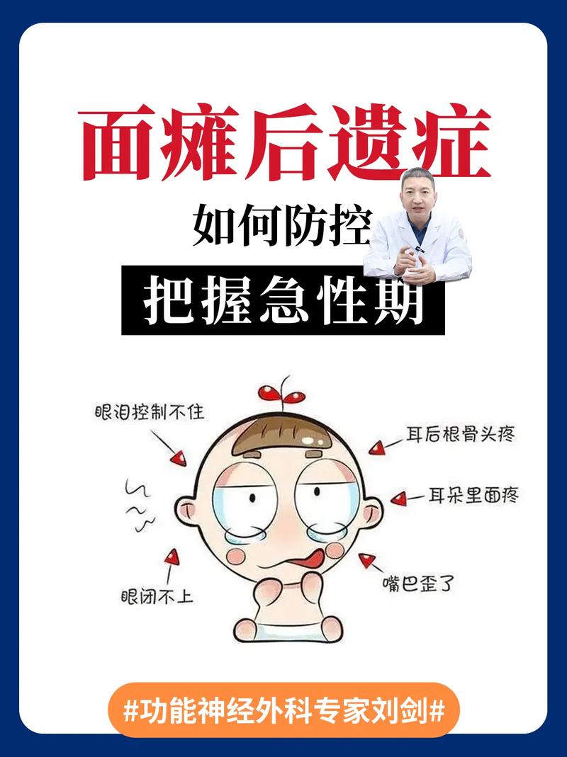孕期面瘫究竟是谁在捣鬼？激素变化还是病毒感染作祟？-第3张图片-郑州医学网