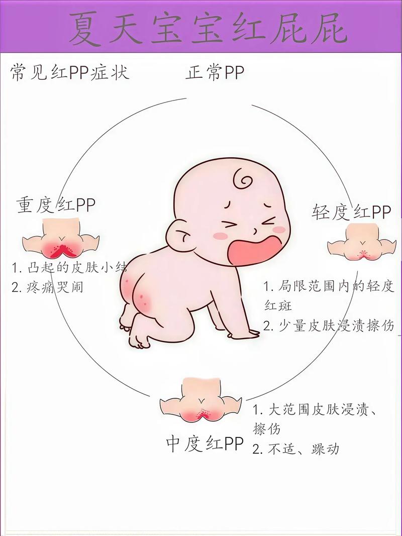 新生儿全身通红是正常生理现象还是疾病信号？需关注哪些伴随症状？-第2张图片-郑州医学网