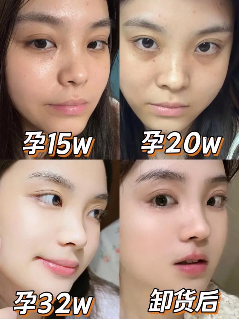 孕期眉毛变淡真能判断生男生女？科学依据是什么？-第1张图片-郑州医学网