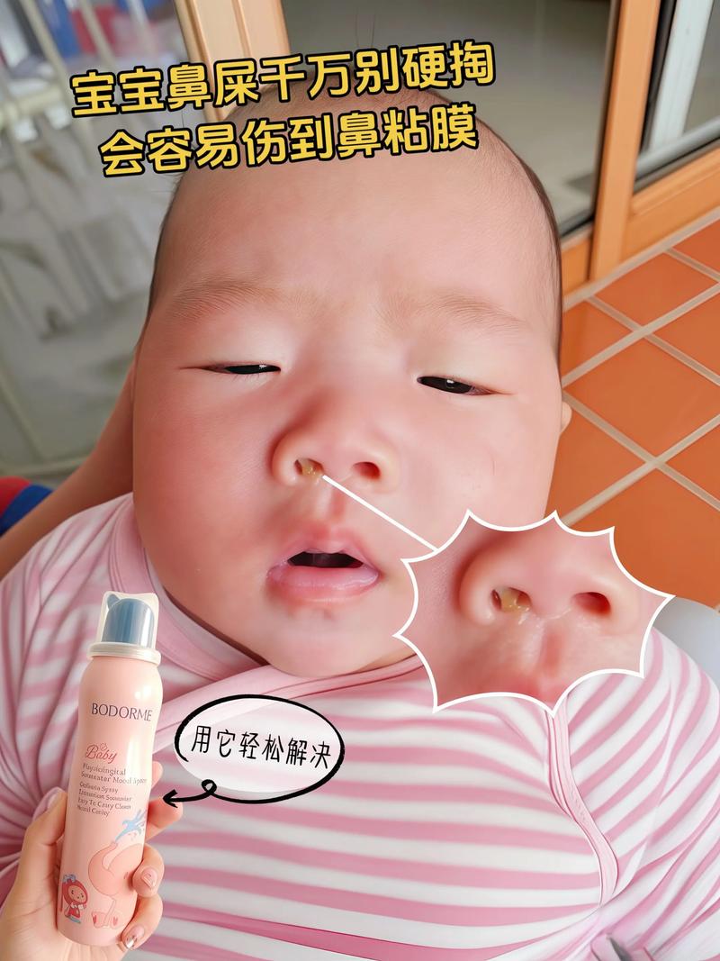 新生儿鼻孔里白色粘稠是正常分泌物还是异常信号？-第2张图片-郑州医学网