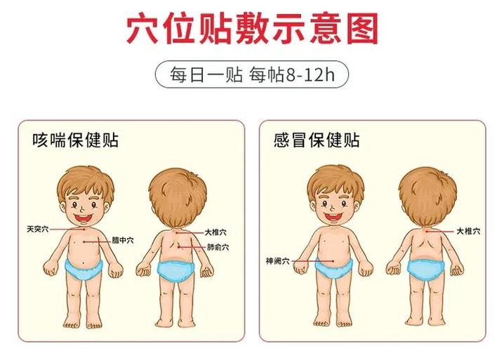 儿童止咳贴该贴哪些部位？不同年龄段宝宝有区别吗？-第2张图片-郑州医学网