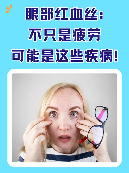 孕期眼睛酸涩是正常生理反应还是疾病信号？需警惕哪些潜在风险？-第1张图片-郑州医学网