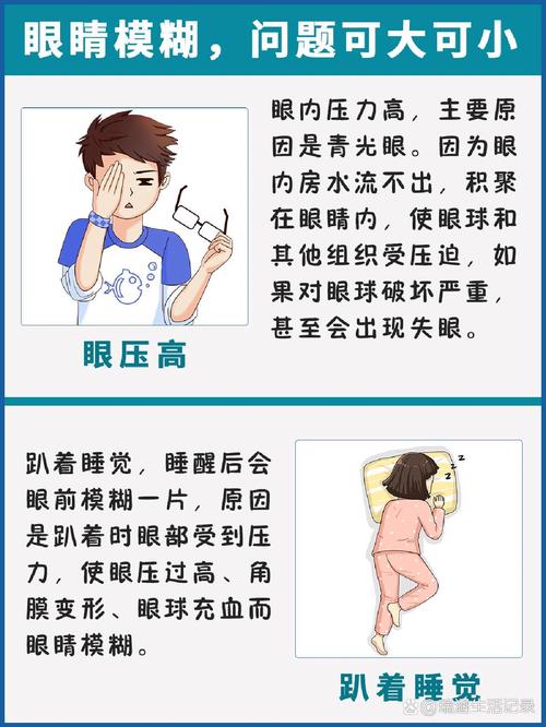 孕期眼睛酸涩是正常生理反应还是疾病信号？需警惕哪些潜在风险？-第3张图片-郑州医学网