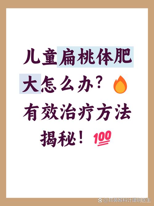 儿童扁桃体肥大的原因-第2张图片-郑州医学网 儿童扁桃体肥大的原因-第2张图片-郑州医学网