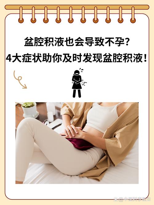 孕期盆腔积液一定会导致流产吗?需要治疗吗?-第2张图片-郑州医学网 孕期盆腔积液一定会导致流产吗?需要治疗吗?-第2张图片-郑州医学网