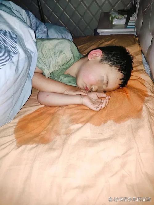 9岁儿童晚上睡觉出汗是缺钙还是体质虚?家长该如何科学应对?-第2张图片-郑州医学网 9岁儿童晚上睡觉出汗是缺钙还是体质虚?家长该如何科学应对?-第2张图片-郑州医学网