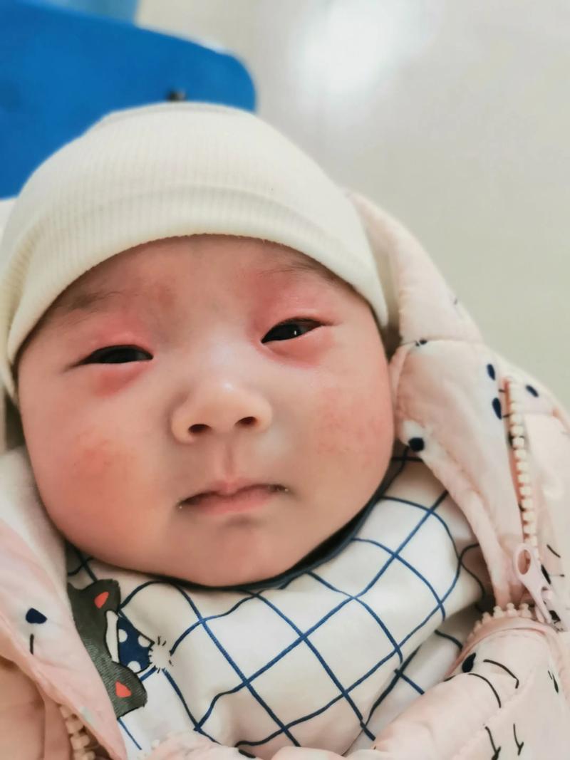 新生儿出生后眼皮肿多久能消肿?正常情况下需要几天?-第1张图片-郑州医学网 新生儿出生后眼皮肿多久能消肿?正常情况下需要几天?-第1张图片-郑州医学网