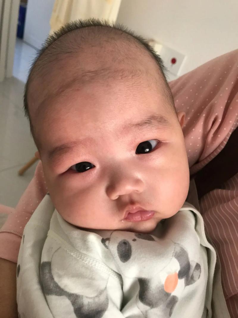 新生儿出生后眼皮肿多久能消肿？正常情况下需要几天？-第3张图片-郑州医学网