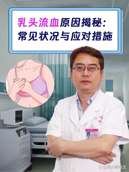 孕期乳头出血怎么回事-第1张图片-郑州医学网