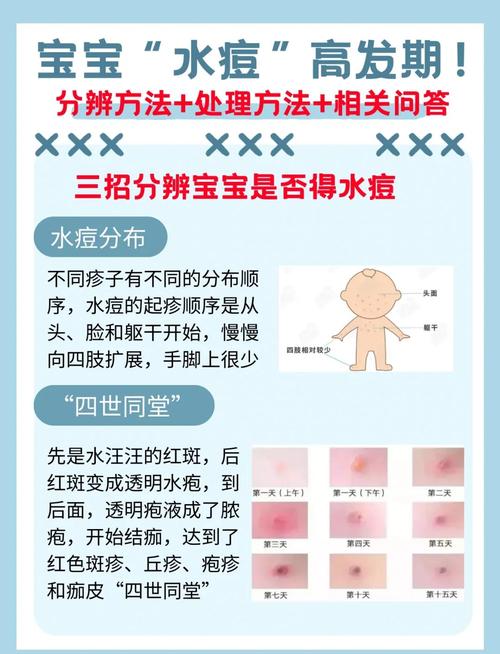 儿童出水痘期间喝牛奶会加重症状吗?有没有科学依据支持这个说法?-第1张图片-郑州医学网 儿童出水痘期间喝牛奶会加重症状吗?有没有科学依据支持这个说法?-第1张图片-郑州医学网