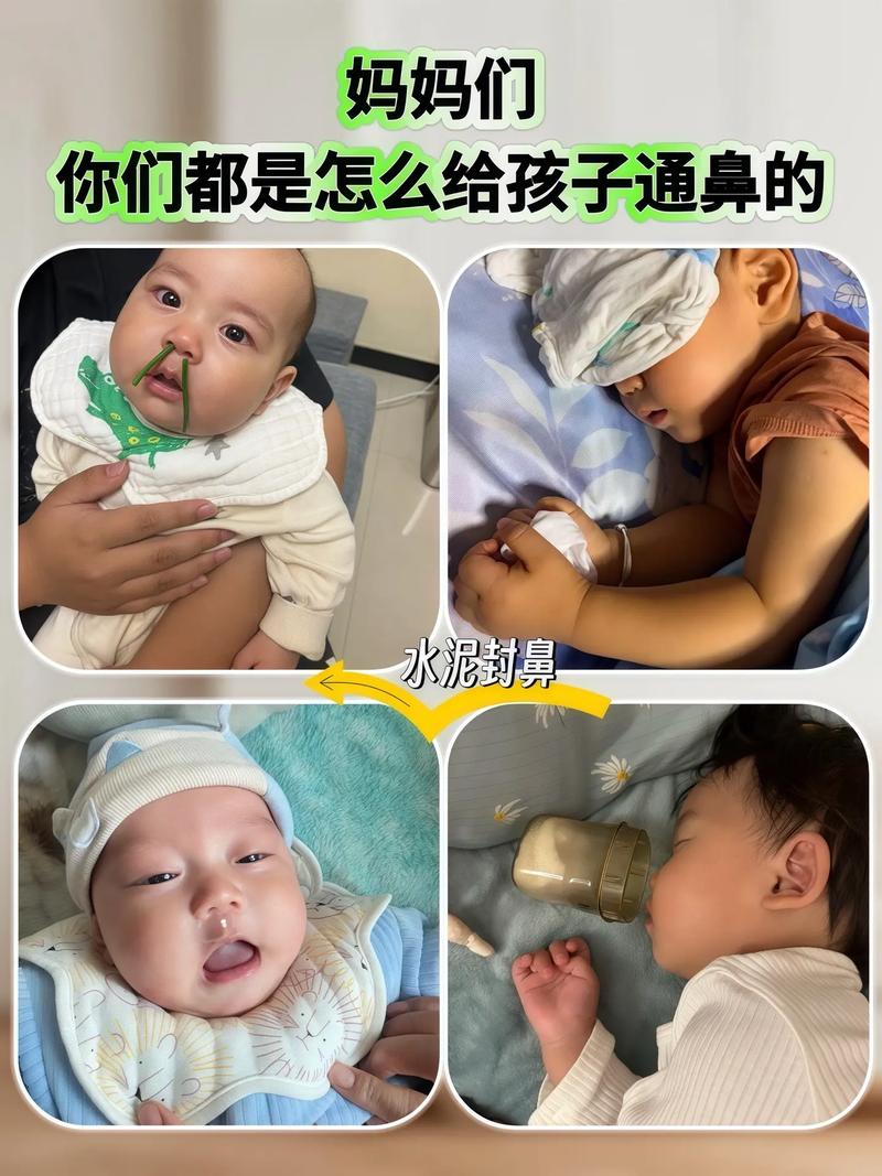 儿童鼻屎多究竟是什么原因导致的？是上火、疾病还是不良习惯在作祟？-第3张图片-郑州医学网