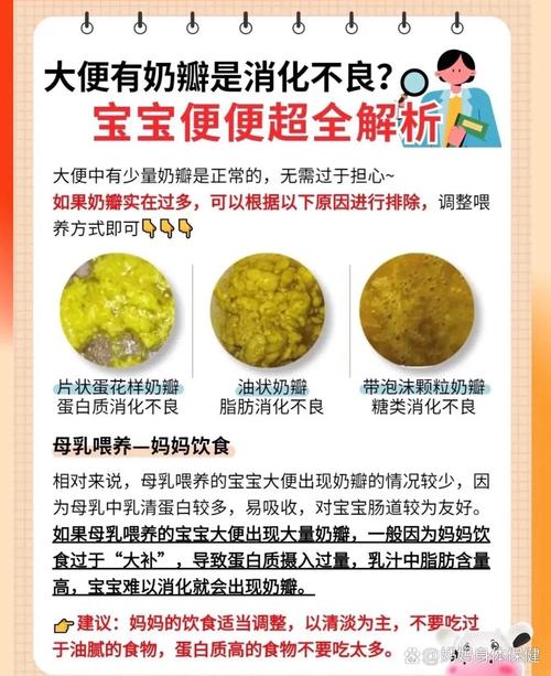 新生儿吃完奶粉就拉屎是消化不良还是生理性腹泻？-第2张图片-郑州医学网