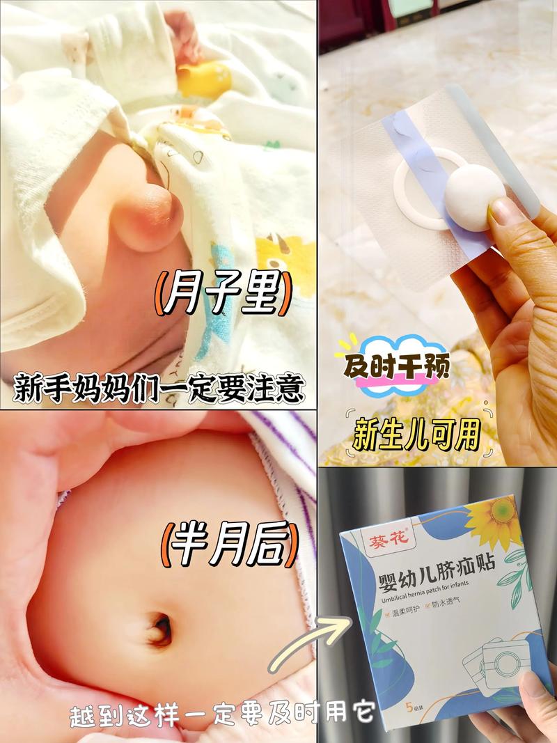 新生儿肚脐外凸正常吗-第1张图片-郑州医学网 新生儿肚脐外凸正常吗-第1张图片-郑州医学网
