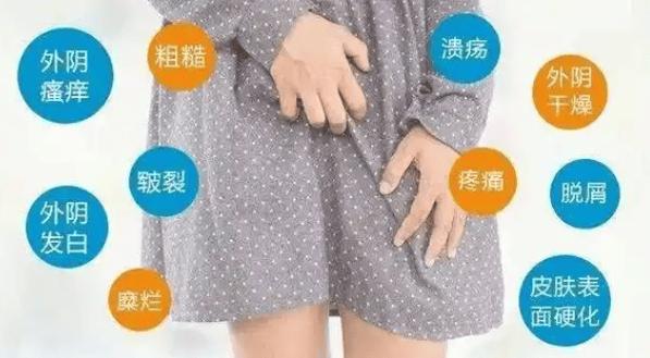 孕期用力大便后阴唇肿大,是正常现象还是危险信号?-第1张图片-郑州医学网 孕期用力大便后阴唇肿大,是正常现象还是危险信号?-第1张图片-郑州医学网