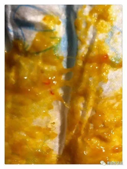 新生儿大便出现血丝和粘液是何原因?需要立即就医还是可在家观察?-第1张图片-郑州医学网 新生儿大便出现血丝和粘液是何原因?需要立即就医还是可在家观察?-第1张图片-郑州医学网