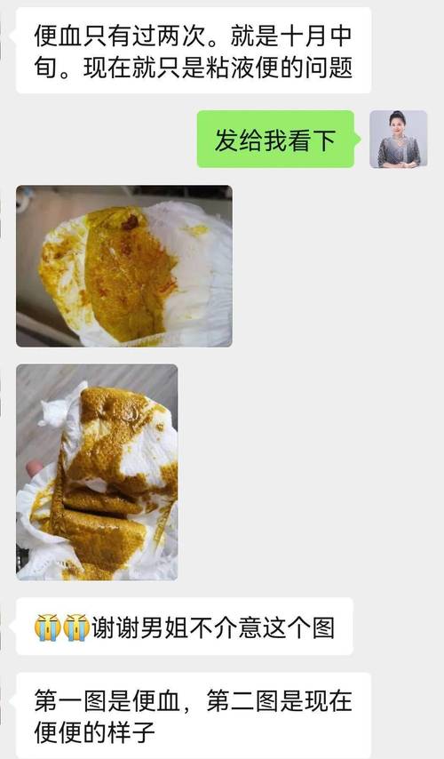 新生儿大便出现血丝和粘液是何原因？需要立即就医还是可在家观察？-第2张图片-郑州医学网