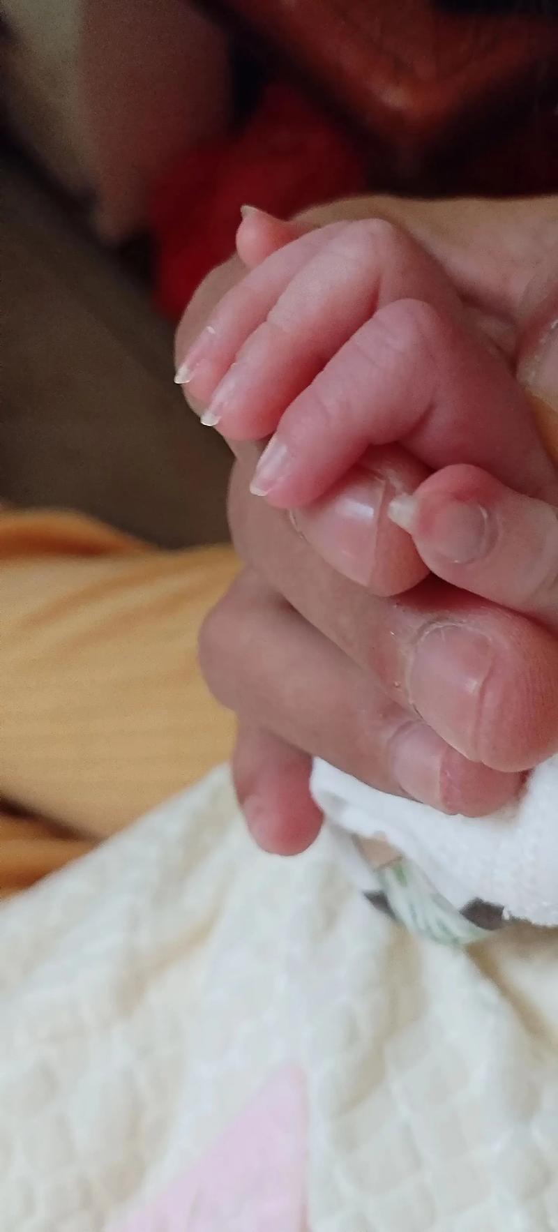新生儿指甲正常图片是什么样？红润还是苍白？长度如何修剪才安全？-第2张图片-郑州医学网
