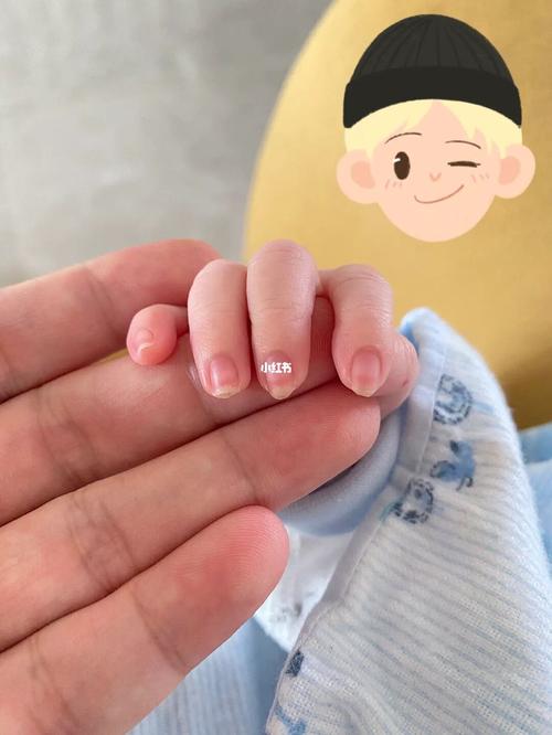 新生儿指甲正常图片是什么样？红润还是苍白？长度如何修剪才安全？-第3张图片-郑州医学网