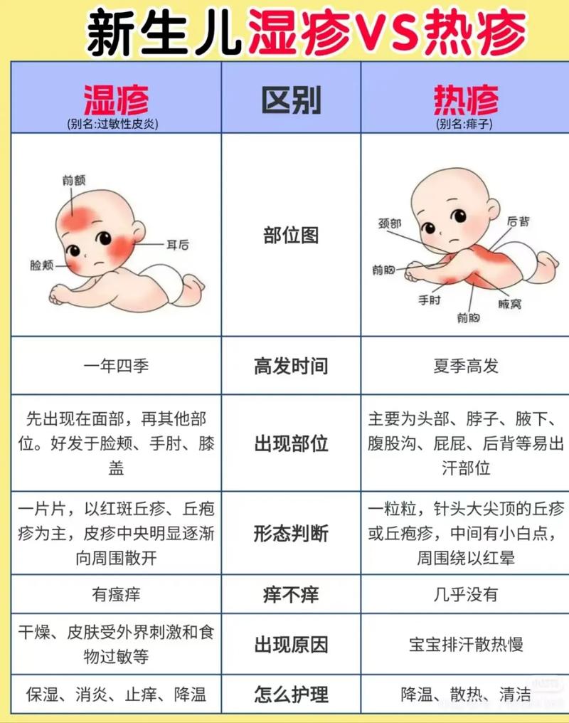新生儿湿疹到底能不能洗澡？洗澡时要注意哪些问题才能避免加重？-第1张图片-郑州医学网