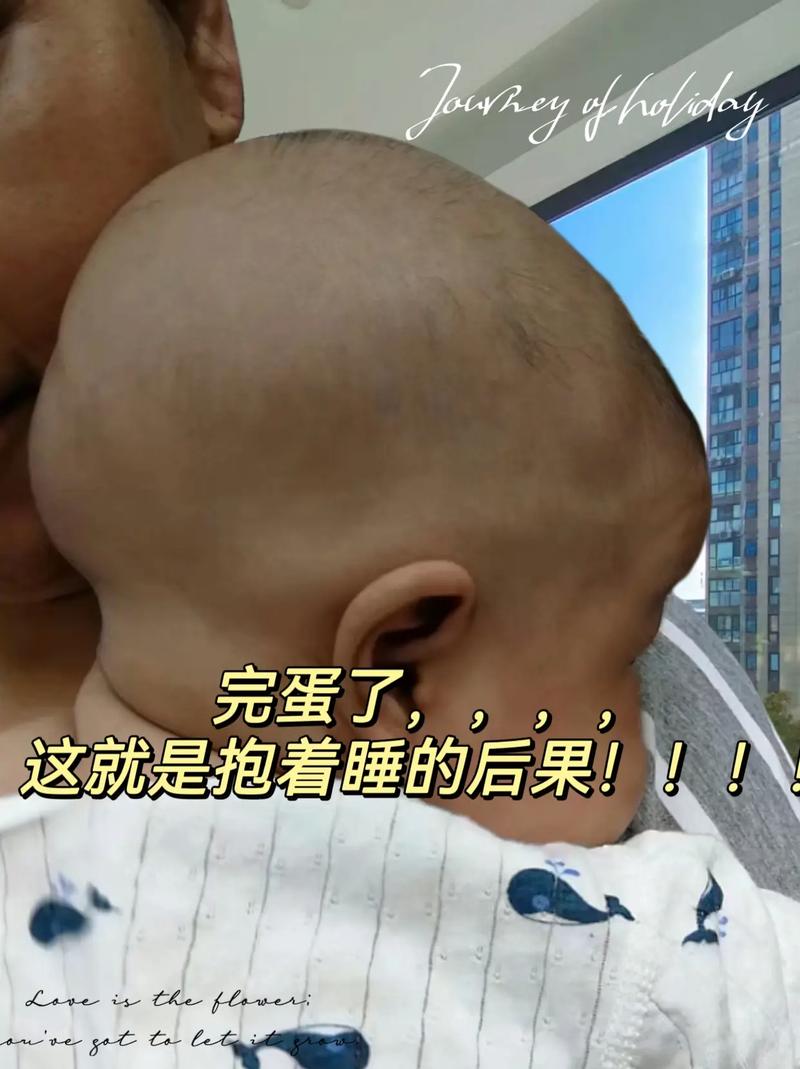 新生儿头后部骨头突出是正常现象还是异常表现？需要警惕哪些疾病风险？-第2张图片-郑州医学网