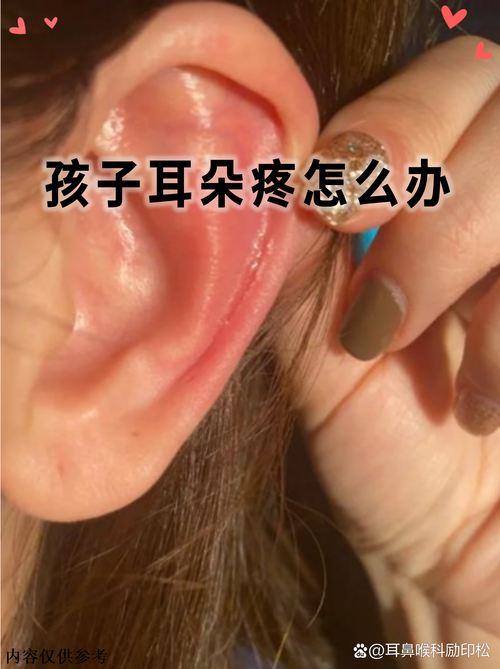 儿童发烧耳朵疼怎么办-第3张图片-郑州医学网