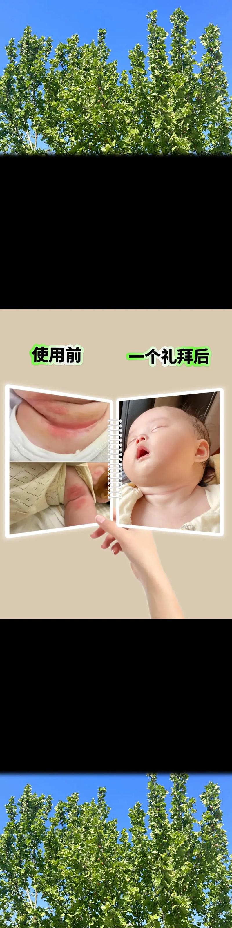 新生儿身上有黑毛刺怎么办？需要去除吗？正确处理方法是什么？-第2张图片-郑州医学网