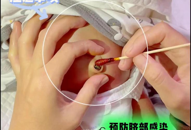 新生儿肠道感染有哪些典型症状?家长该如何识别与应对?-第1张图片-郑州医学网 新生儿肠道感染有哪些典型症状?家长该如何识别与应对?-第1张图片-郑州医学网