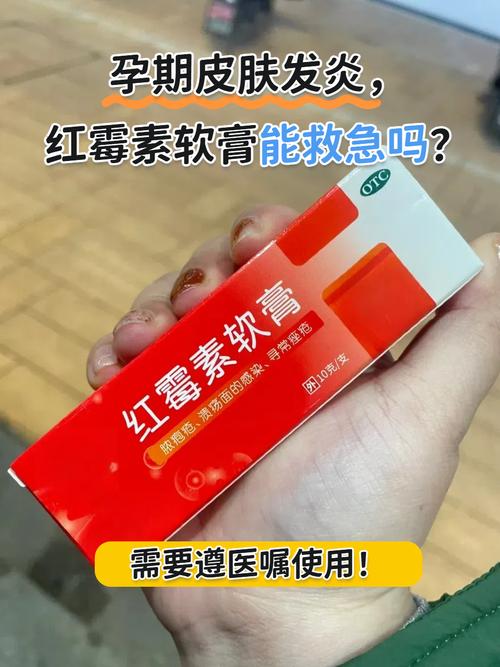 怀孕期间用药膏安全吗?哪些成分要避开,对胎儿有影响吗?-第1张图片-郑州医学网 怀孕期间用药膏安全吗?哪些成分要避开,对胎儿有影响吗?-第1张图片-郑州医学网