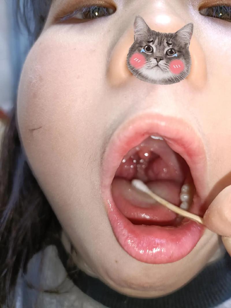 新生儿睡觉喉咙总发出咕咕响,是正常现象还是生病了?-第3张图片-郑州医学网 新生儿睡觉喉咙总发出咕咕响,是正常现象还是生病了?-第3张图片-郑州医学网