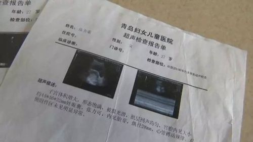 怀孕期间B超检查次数多少合适？不同阶段频率有何差异？-第3张图片-郑州医学网