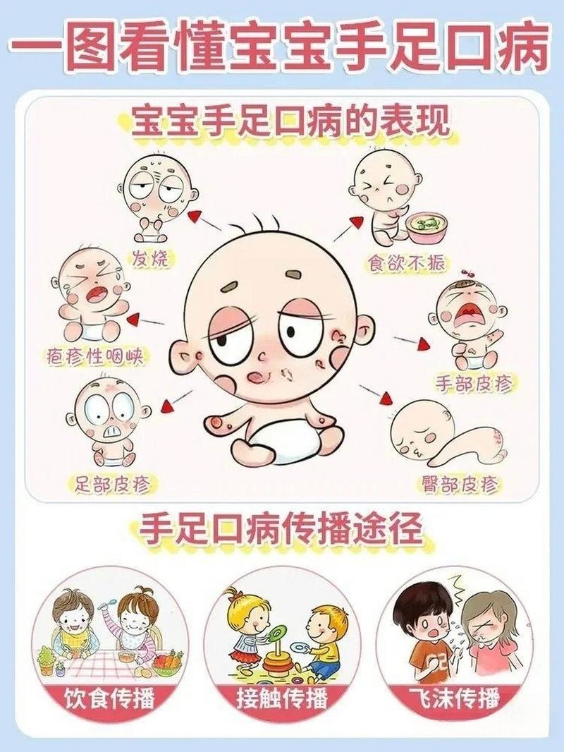 新手爸妈如何准确判断新生儿手足口病？这些关键症状别忽略！-第1张图片-郑州医学网