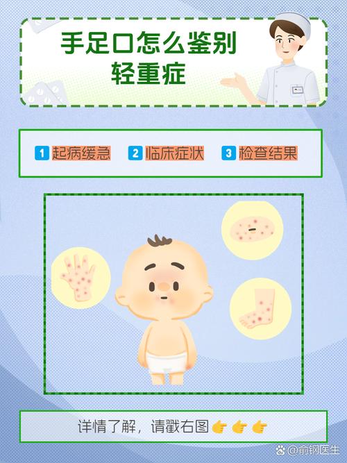 新手爸妈如何准确判断新生儿手足口病？这些关键症状别忽略！-第3张图片-郑州医学网