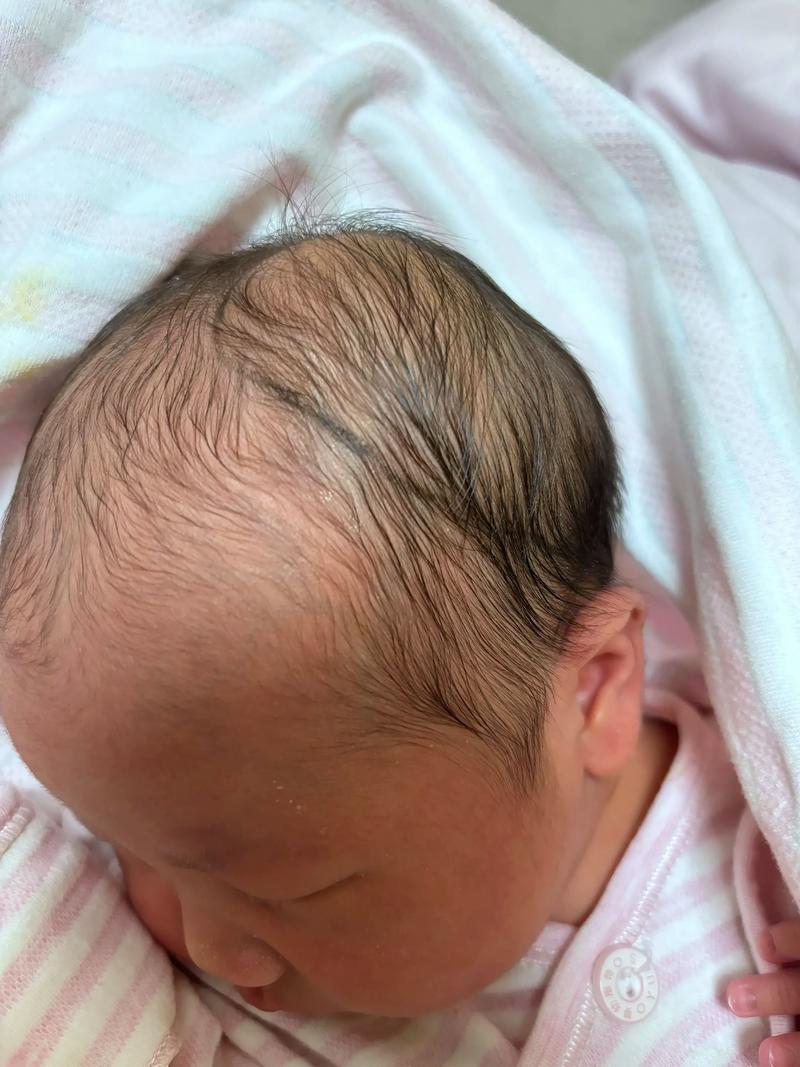 新生儿头颅血肿到底能不能热敷？这样做会不会加重风险？-第1张图片-郑州医学网