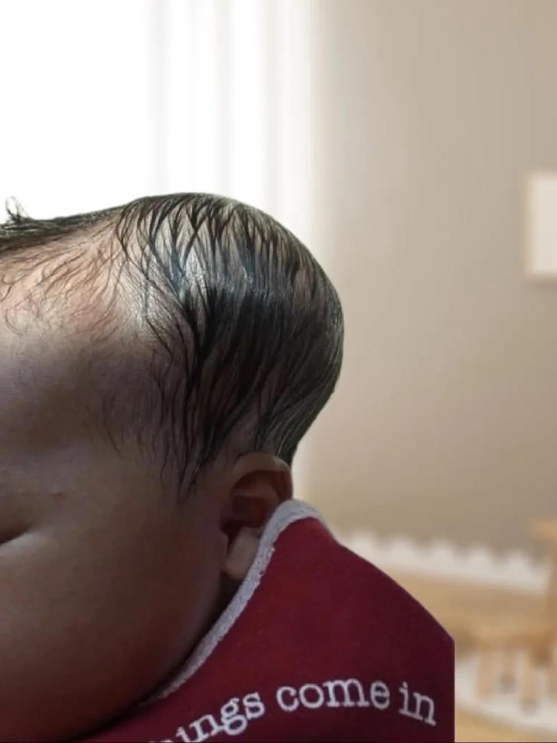 新生儿头颅血肿到底能不能热敷？这样做会不会加重风险？-第3张图片-郑州医学网