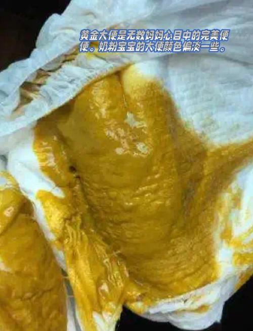 新生儿大便后清洗，怎样做才能既干净又保护娇嫩肌肤？-第2张图片-郑州医学网