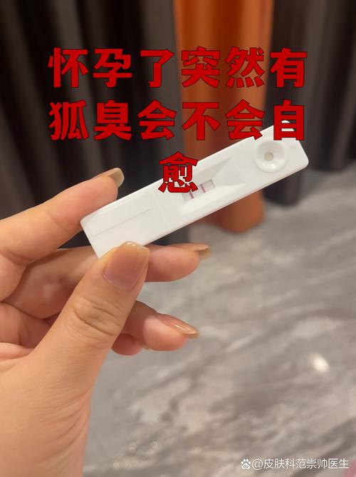 怀孕期间狐臭会加重吗?激素变化对狐臭症状有哪些具体影响?-第1张图片-郑州医学网 怀孕期间狐臭会加重吗?激素变化对狐臭症状有哪些具体影响?-第1张图片-郑州医学网