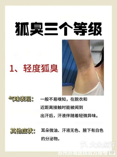 怀孕期间狐臭会加重吗?激素变化对狐臭症状有哪些具体影响?-第3张图片-郑州医学网 怀孕期间狐臭会加重吗?激素变化对狐臭症状有哪些具体影响?-第3张图片-郑州医学网