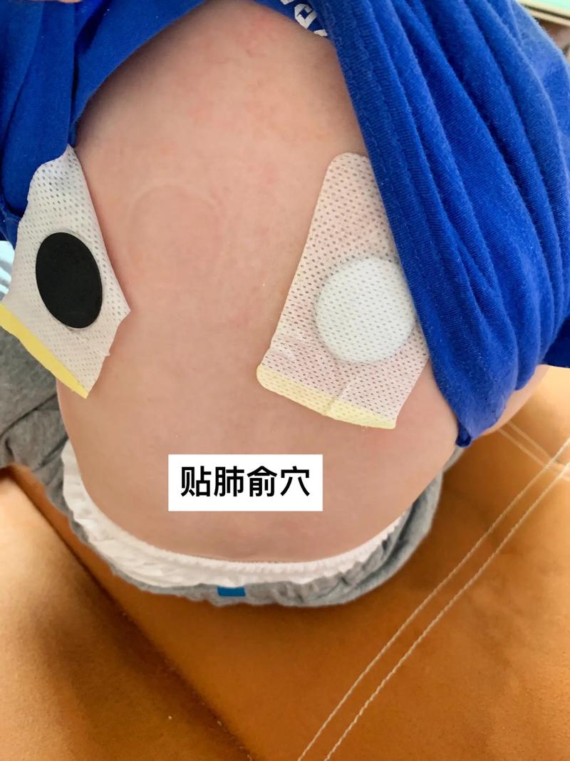 儿童咳嗽艾灸位置图片,哪些穴位最有效?操作时要注意什么?-第3张图片-郑州医学网 儿童咳嗽艾灸位置图片,哪些穴位最有效?操作时要注意什么?-第3张图片-郑州医学网