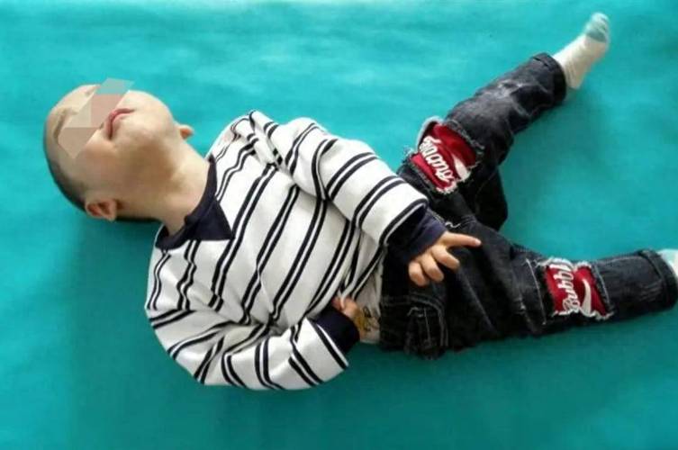 儿童抽搐早期症状有哪些表现？家长如何识别与应对？-第1张图片-郑州医学网