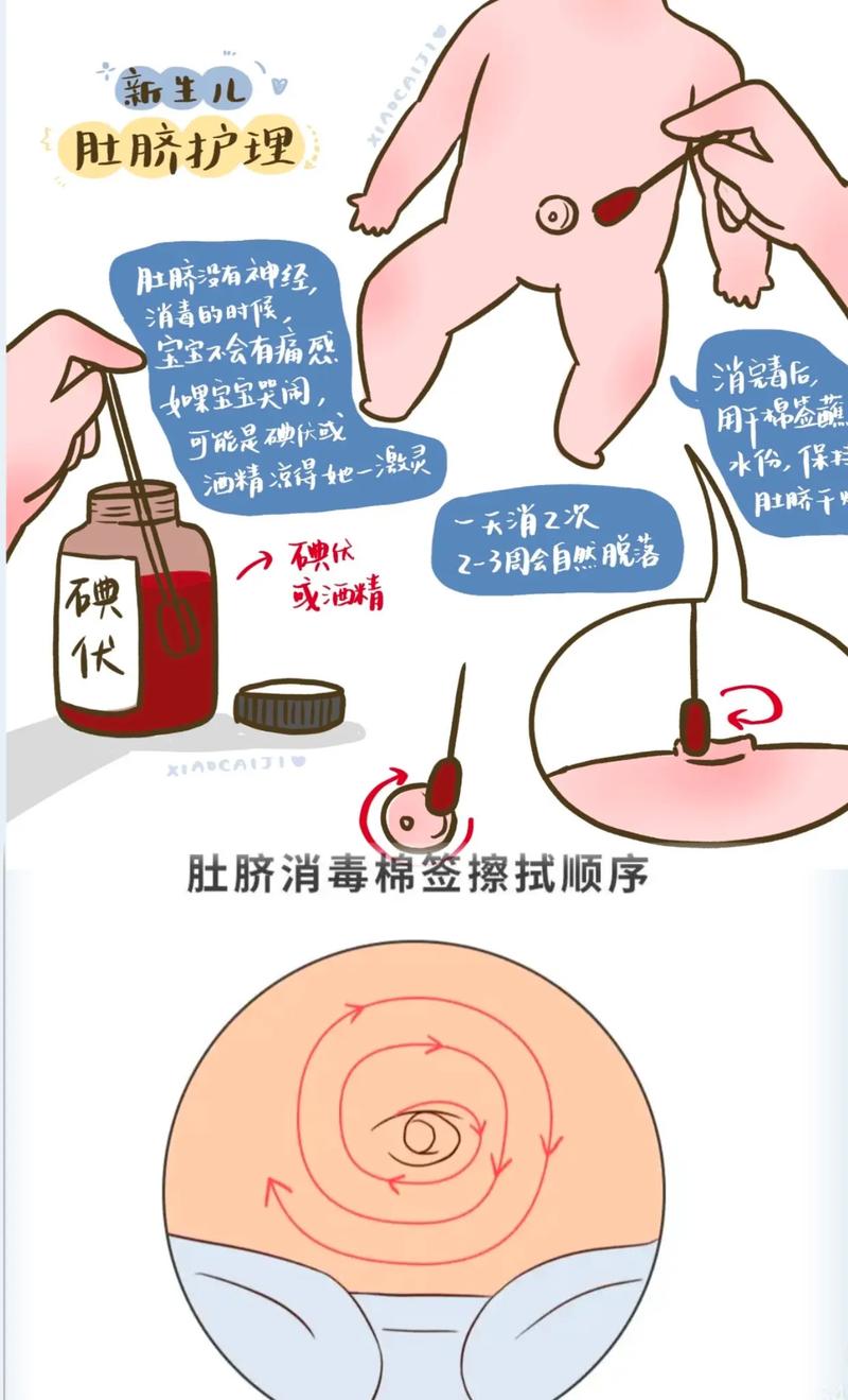 新生儿肚脐夹脱落前需要每天消毒吗？脱落时出血正常吗？护理要注意什么？-第1张图片-郑州医学网