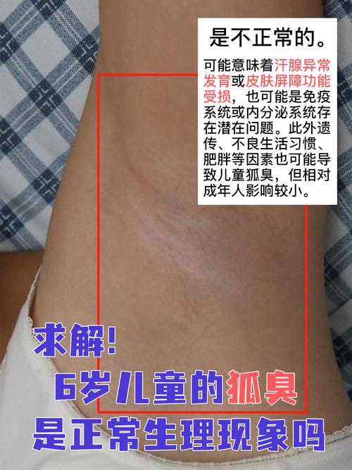 儿童狐臭治疗最佳年龄-第1张图片-郑州医学网 儿童狐臭治疗最佳年龄-第1张图片-郑州医学网